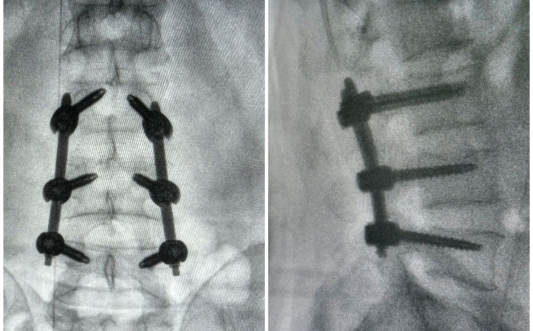 1763621078965480.png 1763621078965480.png