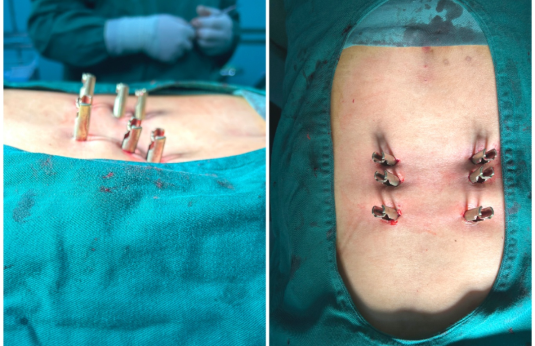 1763621099189724.png 1763621099189724.png