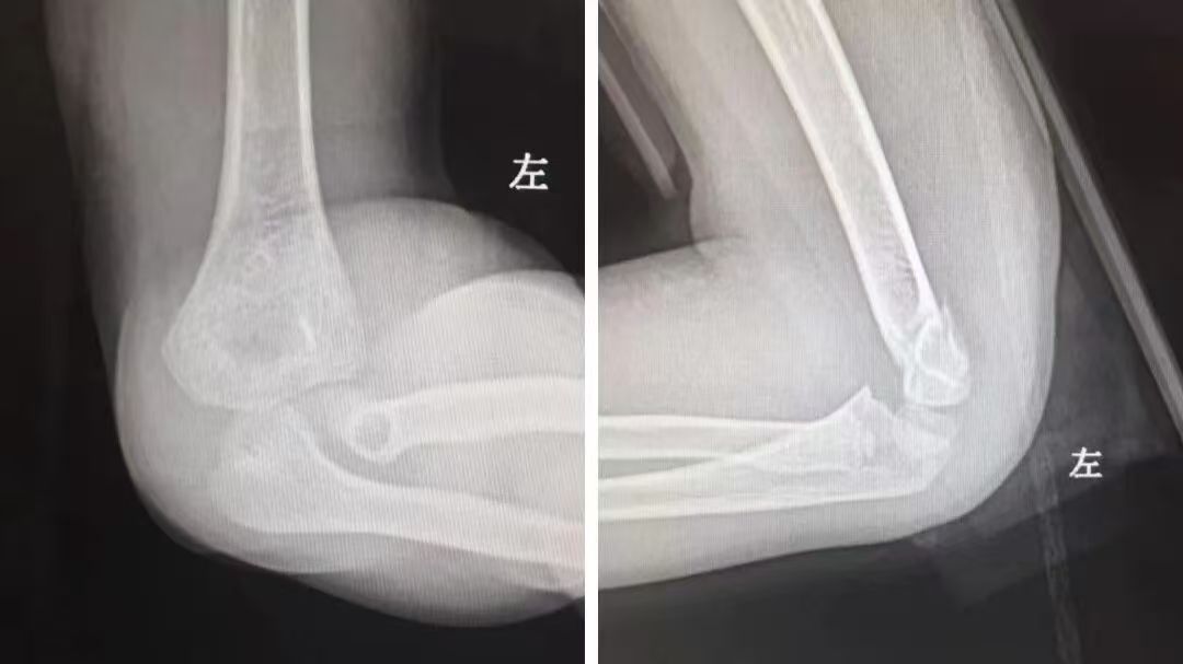 1764316753944926.jpg 1764316753944926.jpg