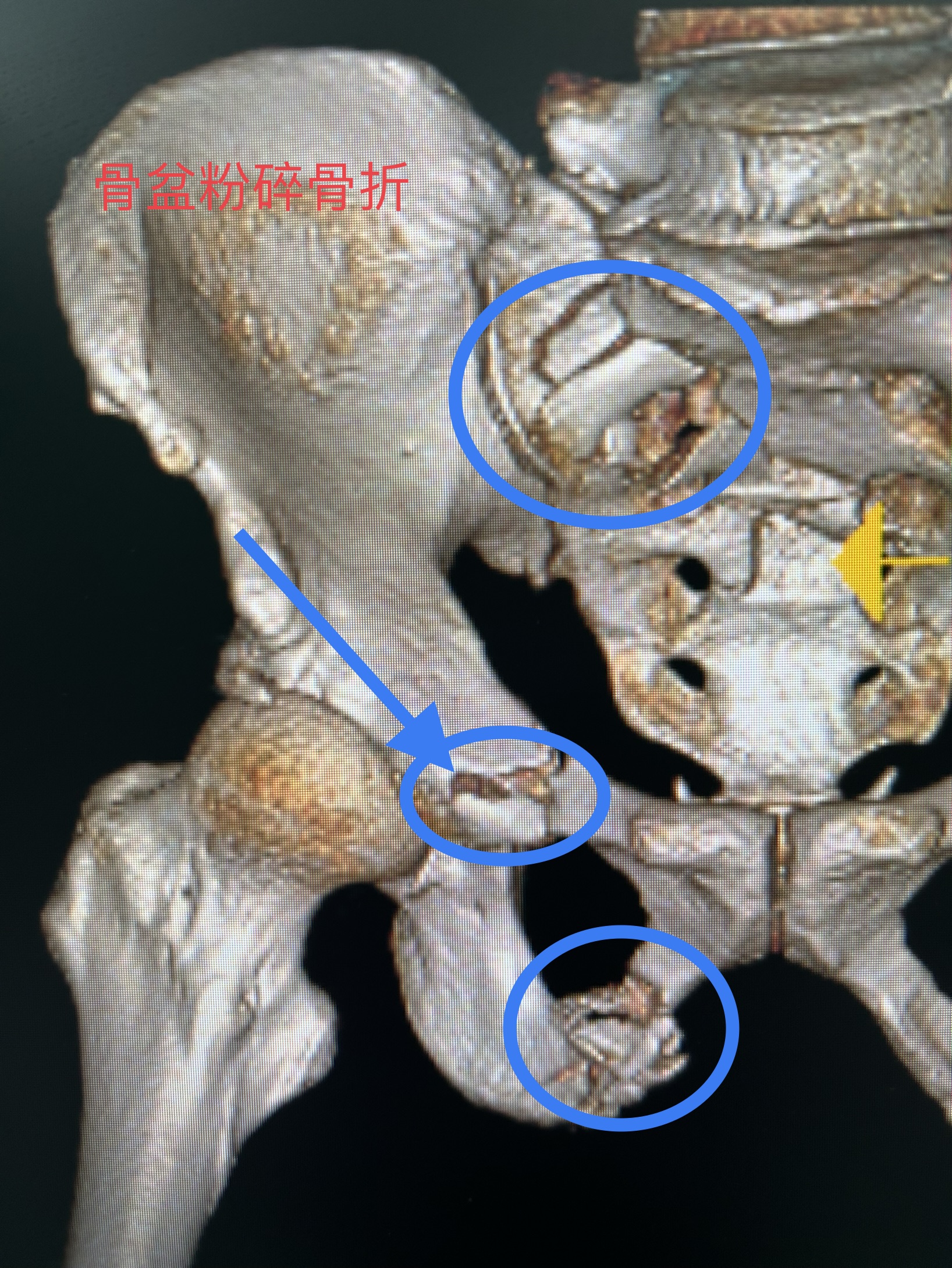 1764916905131530.jpg 1764916905131530.jpg