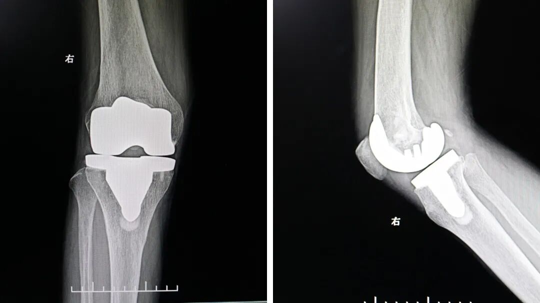 1767486989738469.jpg 1767486989738469.jpg